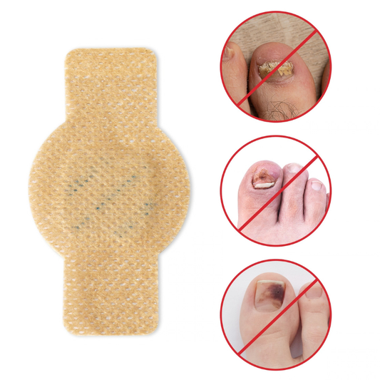 Plasturi pentru tratarea ciupercii unghiei